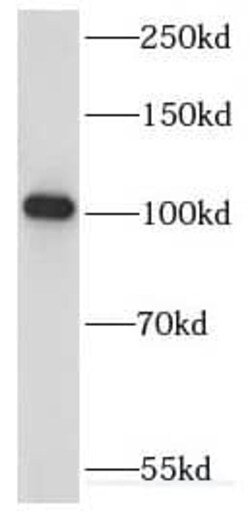 KIF18A Antibody - BSA Free, Novus Biologicals 100 &mu;g | Buy Online | Novus Biologicals | Fisher Scientific