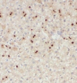 KIF18A Antibody - BSA Free, Novus Biologicals 100 &mu;g | Buy Online | Novus Biologicals | Fisher Scientific