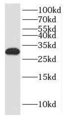 KCTD14 Antibody - BSA Free, Novus Biologicals 100 &mu;g | Buy Online | Novus Biologicals | Fisher Scientific