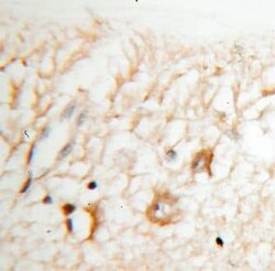 Kv9.2 Antibody - BSA Free, Novus Biologicals 100 &mu;g | Buy Online | Novus Biologicals | Fisher Scientific