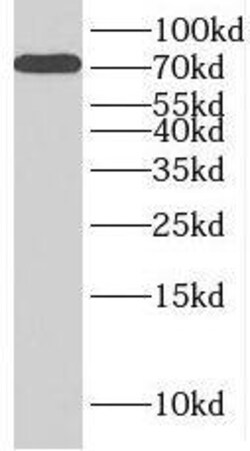 RC74 Antibody - BSA Free, Novus Biologicals 100 &mu;g | Buy Online | Novus Biologicals | Fisher Scientific