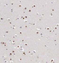 DKFZP434B168 Antibody - BSA Free, Novus Biologicals 100 &mu;g | Buy Online | Novus Biologicals | Fisher Scientific