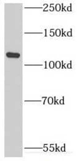 INT3 Antibody - BSA Free, Novus Biologicals 100 &mu;g | Buy Online | Novus Biologicals | Fisher Scientific