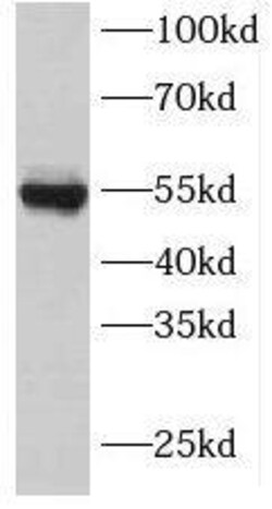 INSC Antibody - BSA Free, Novus Biologicals 100 &mu;g | Buy Online | Novus Biologicals | Fisher Scientific