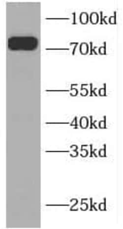 INPP5B Antibody - BSA Free, Novus Biologicals 100 &mu;g | Buy Online | Novus Biologicals | Fisher Scientific