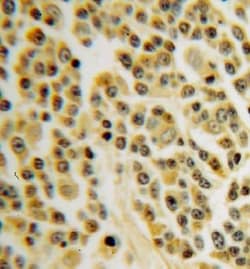 INPP5B Antibody - BSA Free, Novus Biologicals 100 &mu;g | Buy Online | Novus Biologicals | Fisher Scientific