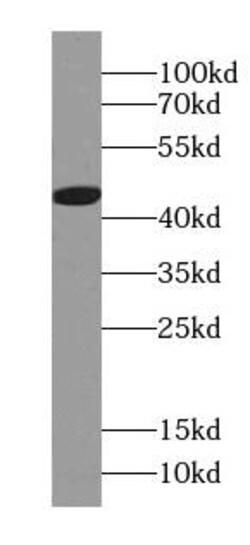 RP5-1077B9.4 Antibody - BSA Free, Novus Biologicals 100 &mu;g | Buy Online | Novus Biologicals | Fisher Scientific