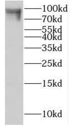 Ift80 Antibody - BSA Free, Novus Biologicals 100 &mu;g | Buy Online | Novus Biologicals | Fisher Scientific