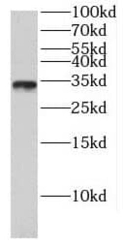 FAM92A1 Antibody - BSA Free, Novus Biologicals 100 &mu;g | Buy Online | Novus Biologicals | Fisher Scientific