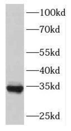 FAM71E2 Antibody - BSA Free, Novus Biologicals 100 &mu;g | Buy Online | Novus Biologicals | Fisher Scientific