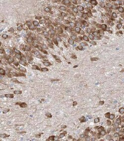 FAM114A1 Antibody - BSA Free, Novus Biologicals 100 &mu;g | Buy Online | Novus Biologicals | Fisher Scientific