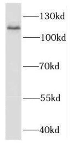 EXOC6 Antibody - BSA Free, Novus Biologicals 100 &mu;g | Buy Online | Novus Biologicals | Fisher Scientific