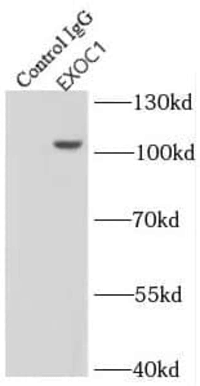 Sec3 SEC3 Antibody - BSA Free, Novus Biologicals 100 μg; Unconjugated ...