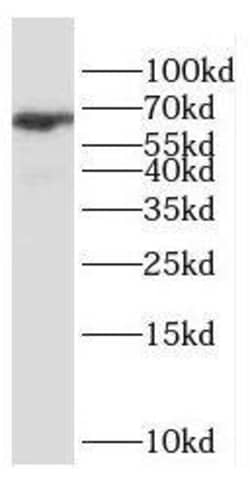 ESX1 Antibody - BSA Free, Novus Biologicals 100 &mu;g | Buy Online | Novus Biologicals | Fisher Scientific