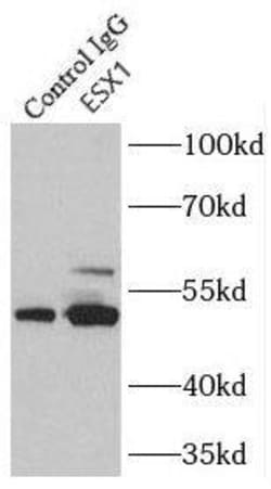 ESX1 Antibody - BSA Free, Novus Biologicals 100 &mu;g | Buy Online | Novus Biologicals | Fisher Scientific
