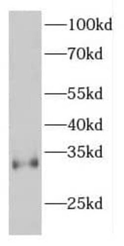 espin Antibody - BSA Free, Novus Biologicals 100 &mu;g | Buy Online | Novus Biologicals | Fisher Scientific