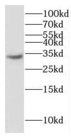 ERGIC1 Antibody - BSA Free, Novus Biologicals 100 &mu;g | Buy Online | Novus Biologicals | Fisher Scientific