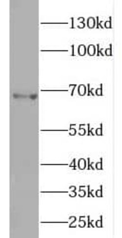 ENC1 Antibody - BSA Free, Novus Biologicals 100 &mu;g | Buy Online | Novus Biologicals | Fisher Scientific