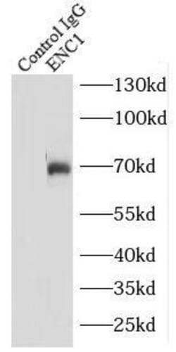 ENC1 Antibody - BSA Free, Novus Biologicals 100 &mu;g | Buy Online | Novus Biologicals | Fisher Scientific