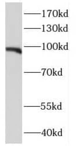 E2F7 Antibody - BSA Free, Novus Biologicals 100 &mu;g | Buy Online | Novus Biologicals | Fisher Scientific