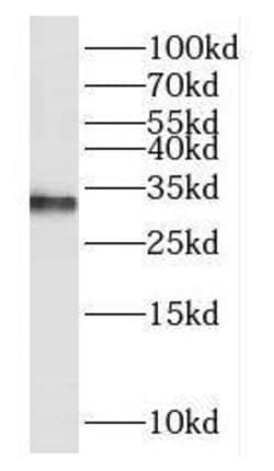 DUSP15 Antibody - BSA Free, Novus Biologicals 100 &mu;g | Buy Online | Novus Biologicals | Fisher Scientific