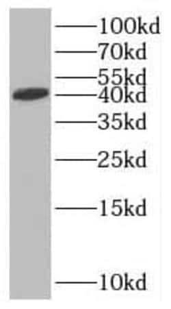 RTCD1 Antibody - BSA Free, Novus Biologicals 100 &mu;g | Buy Online | Novus Biologicals | Fisher Scientific