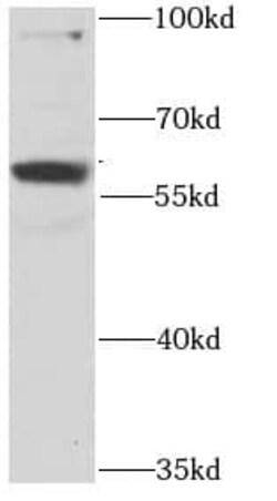 RPS6KL1 Antibody - BSA Free, Novus Biologicals 100 &mu;g | Buy Online | Novus Biologicals | Fisher Scientific