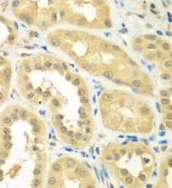 RPS6KL1 Antibody - BSA Free, Novus Biologicals 100 &mu;g | Buy Online | Novus Biologicals | Fisher Scientific