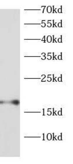 RPS13 Antibody - BSA Free, Novus Biologicals 100 &mu;g | Buy Online | Novus Biologicals | Fisher Scientific