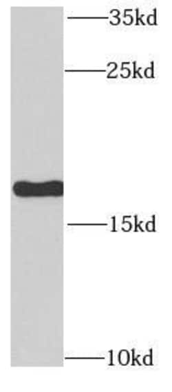 RPLP1 Antibody - BSA Free, Novus Biologicals 100 &mu;g | Buy Online | Novus Biologicals | Fisher Scientific