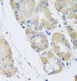 RPLP1 Antibody - BSA Free, Novus Biologicals 100 &mu;g | Buy Online | Novus Biologicals | Fisher Scientific