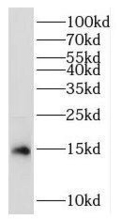 RPL35 Antibody - BSA Free, Novus Biologicals 100 &mu;g | Buy Online | Novus Biologicals | Fisher Scientific