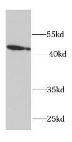 RPH3AL Antibody - BSA Free, Novus Biologicals 100 &mu;g | Buy Online | Novus Biologicals | Fisher Scientific