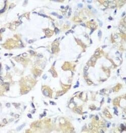 RPH3AL Antibody - BSA Free, Novus Biologicals 100 &mu;g | Buy Online | Novus Biologicals | Fisher Scientific