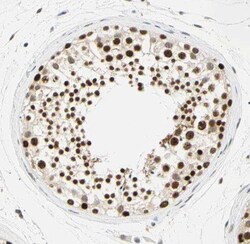 RNF17 Antibody - BSA Free, Novus Biologicals 100 &mu;g | Buy Online | Novus Biologicals | Fisher Scientific