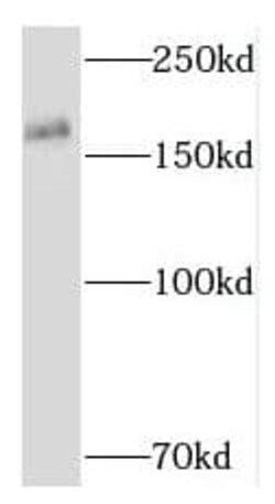 RNF17 Antibody - BSA Free, Novus Biologicals 100 &mu;g | Buy Online | Novus Biologicals | Fisher Scientific