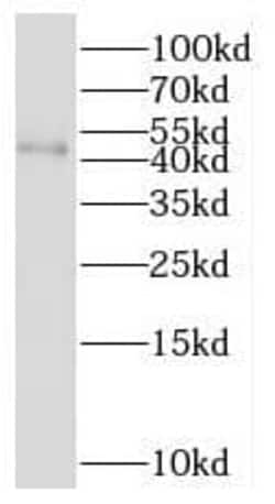 RNF150 Antibody - BSA Free, Novus Biologicals 100 &mu;g | Buy Online | Novus Biologicals | Fisher Scientific