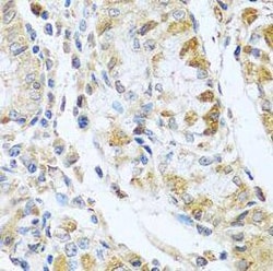 RNASE13 Antibody - BSA Free, Novus Biologicals 100 &mu;g | Buy Online | Novus Biologicals | Fisher Scientific