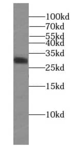 RIMS4 Antibody - BSA Free, Novus Biologicals 100 &mu;g | Buy Online | Novus Biologicals | Fisher Scientific
