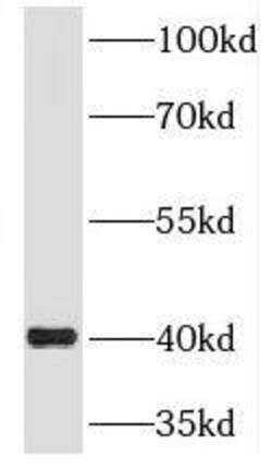 RIMS3 Antibody - BSA Free, Novus Biologicals 100 &mu;g | Buy Online | Novus Biologicals | Fisher Scientific