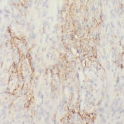 RIC8B Antibody - BSA Free, Novus Biologicals 100 &mu;g | Buy Online | Novus Biologicals | Fisher Scientific