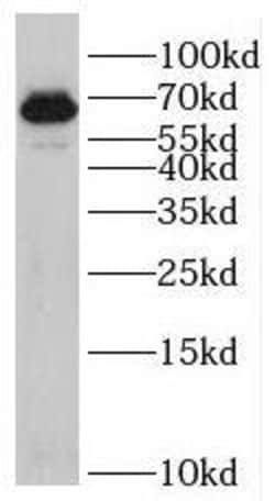 RIC8B Antibody - BSA Free, Novus Biologicals 100 &mu;g | Buy Online | Novus Biologicals | Fisher Scientific