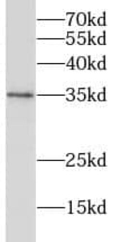 RHBDL2 Antibody - BSA Free, Novus Biologicals 100 &mu;g | Buy Online | Novus Biologicals | Fisher Scientific
