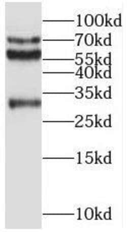 REPS2 Antibody - BSA Free, Novus Biologicals 100 &mu;g | Buy Online | Novus Biologicals | Fisher Scientific