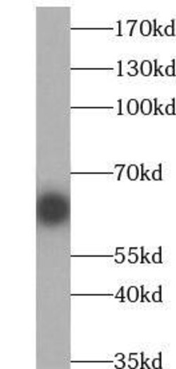 RECQL5 Antibody - BSA Free, Novus Biologicals 100 &mu;g | Buy Online | Novus Biologicals | Fisher Scientific