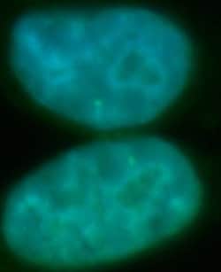 RECQL5 Antibody - BSA Free, Novus Biologicals 100 &mu;g | Buy Online | Novus Biologicals | Fisher Scientific