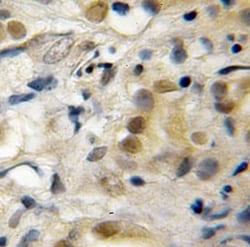 RECQL5 Antibody - BSA Free, Novus Biologicals 100 &mu;g | Buy Online | Novus Biologicals | Fisher Scientific