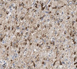 RCAN2 Antibody - BSA Free, Novus Biologicals 100 &mu;g | Buy Online | Novus Biologicals | Fisher Scientific