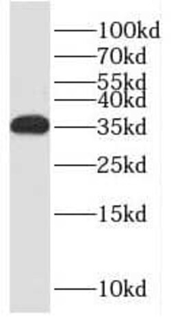 RCAN2 Antibody - BSA Free, Novus Biologicals 100 &mu;g | Buy Online | Novus Biologicals | Fisher Scientific