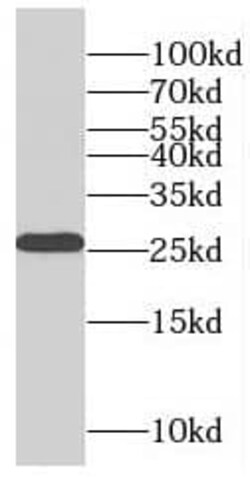 RABL2B Antibody - BSA Free, Novus Biologicals 100 &mu;g | Buy Online | Novus Biologicals | Fisher Scientific